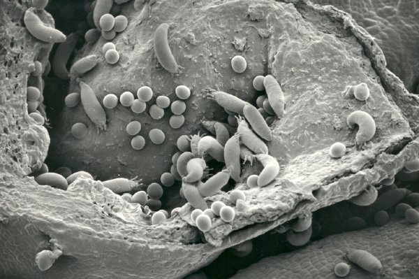SEM Blackcurrant gall mite colony