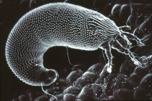 Blackcurrant Gall Mite SEM